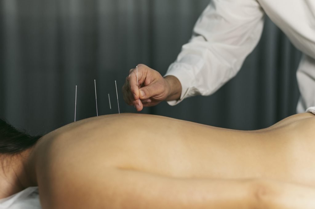Acupuncturist in Helmond