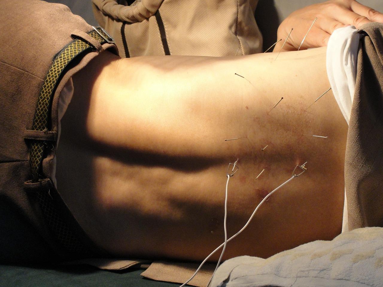 Acupuncturist in Helmond